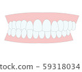 咬合不良，咬傷，牙齒對齊 59318034