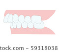 咬合不良，上頜前突，牙齒對齊 59318038