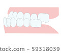 下頜前牙錯合 59318039