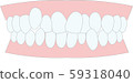 咬合不良擁擠的牙齒 59318040