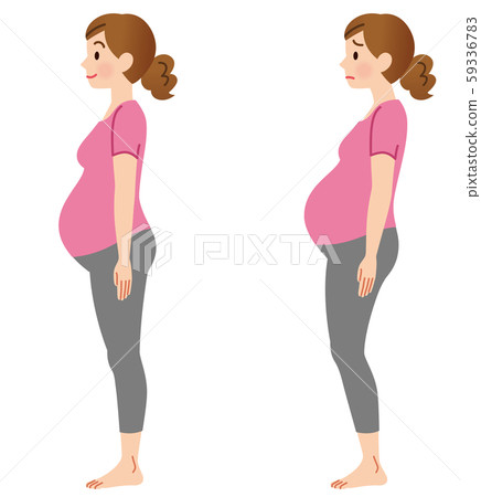 孕婦側身 59336783