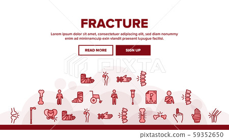 Collection Fracture Elements Vector Sign Icons Set Collection Fracture Elements Vector Sign Icons Set 59352650