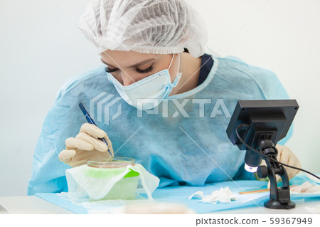 The doctor under the microscope recalculates the hair follicles. Baldness treatment. Hair transplant 59367949