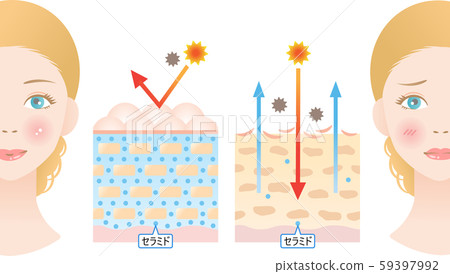神經酰胺健康的皮膚乾燥的皮膚 神經酰胺健康的皮膚乾燥的皮膚 59397992