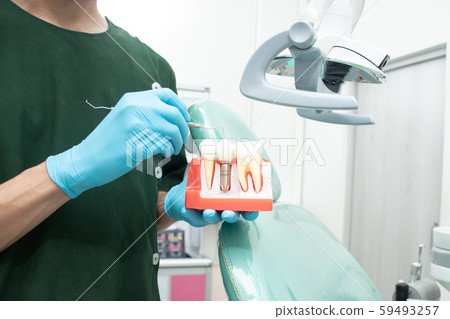 Male dentist carrying a sample of dental implants. 59493257