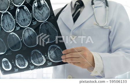 medical brain mri scan medical brain mri scan 59506133