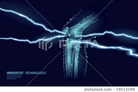 Human knee joint 3d model vector illustration. Low poly design future technology cure pain treatment Human knee joint 3d model vector illustration. Low poly design future technology cure pain treatment 59513299