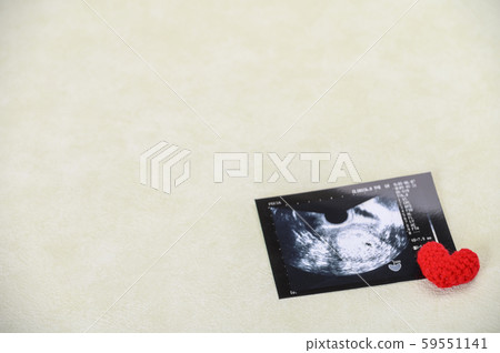 Echo photo of pregnancy life Echo photo of pregnancy life 59551141