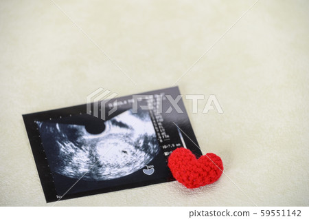 Echo photo of pregnancy life 59551142