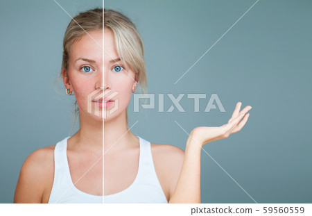 Young Woman with hand raised.  59560559