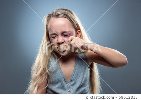 Sad and frightened little girl with bloodshot and bruised eyes, fiction of happiness Sad and frightened little girl with bloodshot and bruised eyes, fiction of happiness 59612815