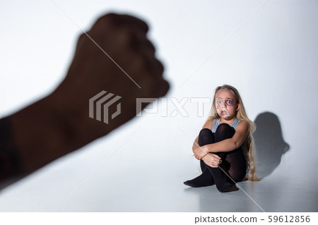 Sad and frightened little girl with bloodshot and bruised eyes sitting scared 59612856