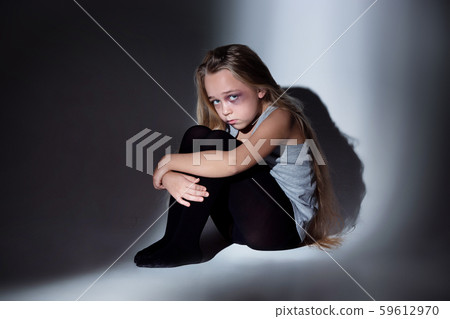 Sad and frightened little girl with bloodshot and bruised eyes sitting scared Sad and frightened little girl with bloodshot and bruised eyes sitting scared 59612970