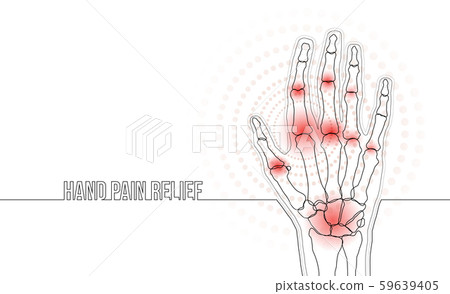 Rheumatoid arthritis continuous line hand bones drawing concept banner 59639405