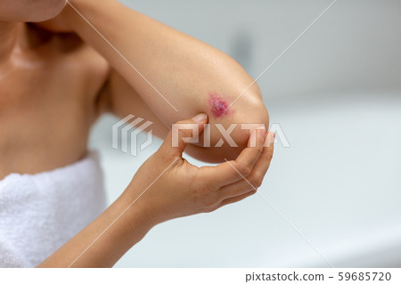 In Pain, ache, pain 59685720