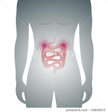 Male silhouette with sick intestine medical vector Male silhouette with sick intestine medical vector 59689055