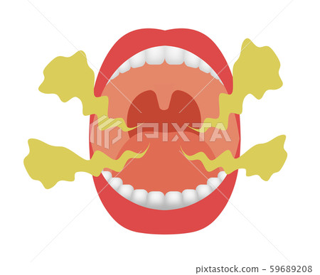 Halitosis 59689208