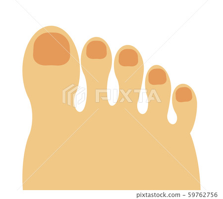 Toe 59762756