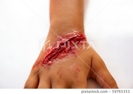 The fake wound on the arm for boy Asia 59765353