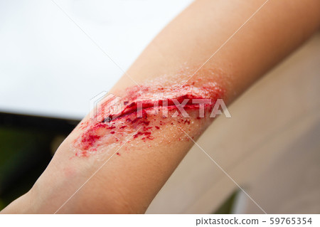 The fake wound on the arm for boy Asia 59765354