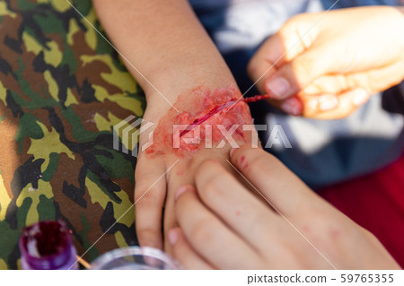 The fake wound on the arm for boy Asia 59765355