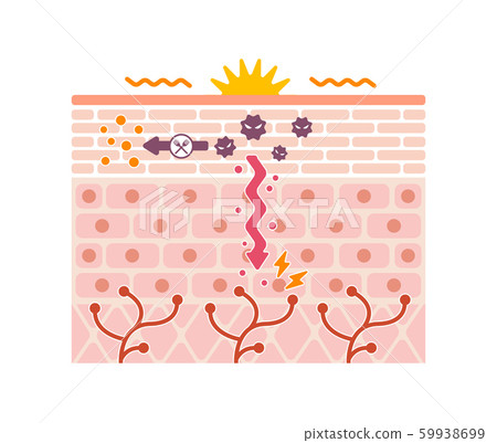Mechanism of athlete's foot itch / cross-sectional view of skin Illustrated illustration (no text) 59938699
