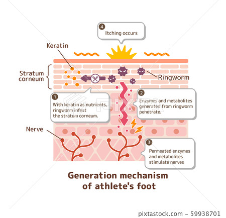 腳癢的機理/皮膚的橫截面圖插圖（帶英語註釋） 59938701
