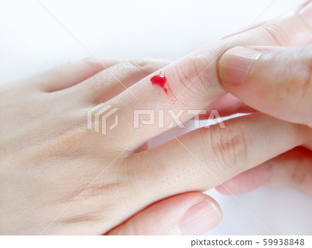 手指受傷 59938848