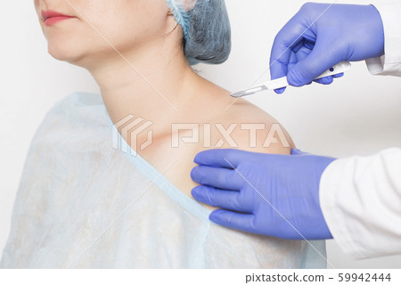 Doctor surgeon holds a scalpel against the background of the shoulder of the girl concept of surgery on the shoulder joint and the replacement of an artificial joint, arthroplasty 59942444