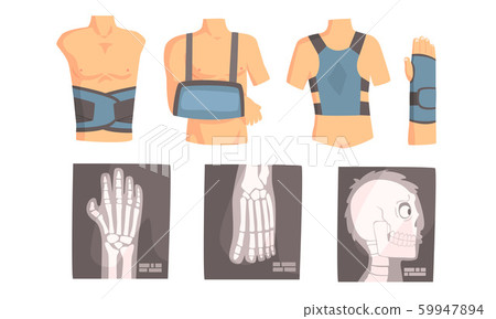 Different types of bandage and xrays. Set of vector illustrations. Different types of bandage and xrays. Set of vector illustrations. 59947894