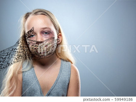 Sad and frightened little girl with bloodshot and bruised eyes, fiction of happiness 59949186