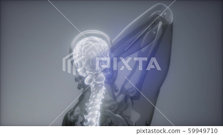 Backache in Back Bones Backache in Back Bones 59949710