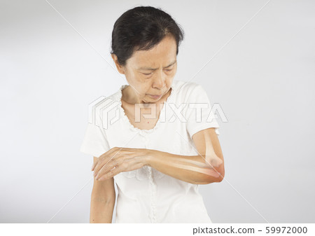 elbow, pain, arthritis 59972000