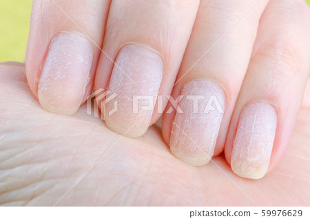 damaged nails after removing modern gel nail polish damaged nails after removing modern gel nail polish 59976629