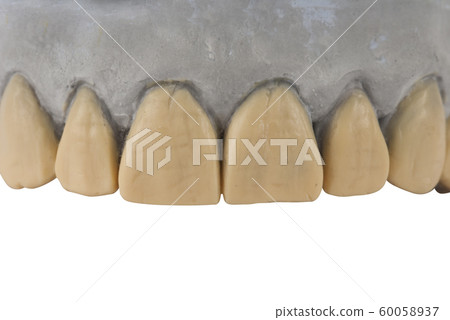 Gypsum model of jaw isolated on white Gypsum model of jaw isolated on white 60058937