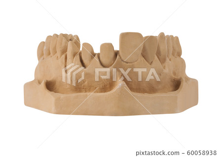 Gypsum model of jaw Gypsum model of jaw 60058938