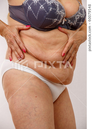 An elderly woman in white panties shows the folds An elderly woman in white panties shows the folds 60079548