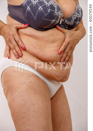 An elderly woman in white panties shows the folds An elderly woman in white panties shows the folds 60079549