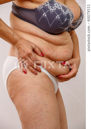 An elderly woman in white panties shows the folds An elderly woman in white panties shows the folds 60079551
