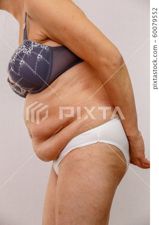 An elderly woman in white panties shows the folds An elderly woman in white panties shows the folds 60079552