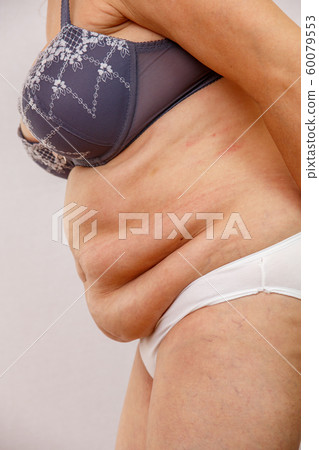 An elderly woman in white panties shows the folds An elderly woman in white panties shows the folds 60079553