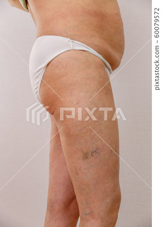 Elderly woman in white panties shows cellulite and 60079572