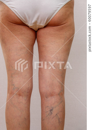 Elderly woman in white panties shows cellulite and 60079597