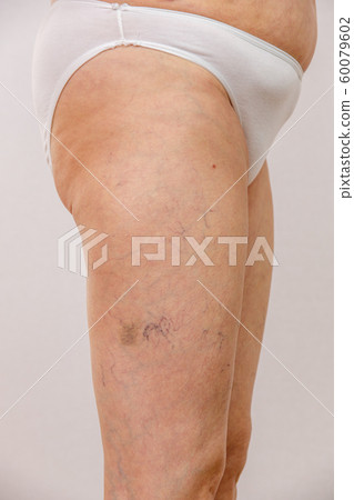 Elderly woman in white panties shows cellulite and 60079602
