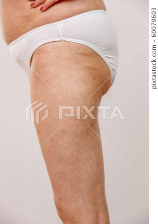 Elderly woman in white panties shows cellulite and 60079603