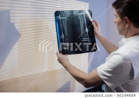 The doctor looks at the patient's x-ray. Work of the clinic doctor The doctor looks at the patient's x-ray. Work of the clinic doctor 60194684
