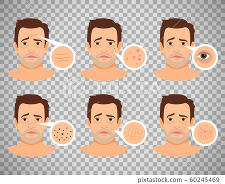 Man skin problems Man skin problems 60245469