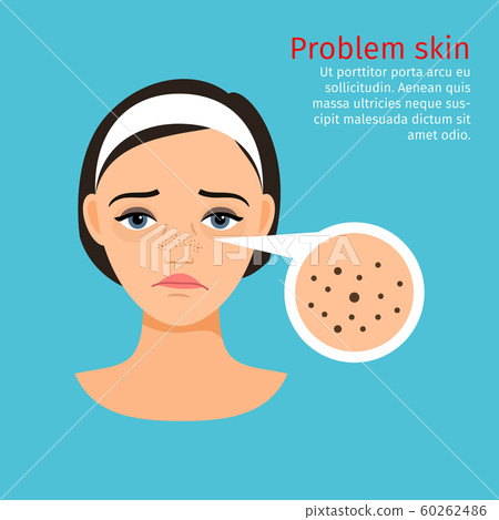 Woman face problem black dots Woman face problem black dots 60262486