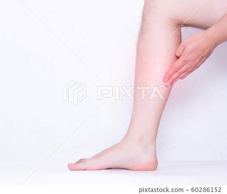 A man rubs a medical ointment in the damaged leg and calf muscle, a healing cream for stretching the ligaments and against inflammation, pain relief, copy space A man rubs a medical ointment in the damaged leg and calf muscle, a healing cream for stretching the ligaments and against inflammation, pain relief, copy space 60286152