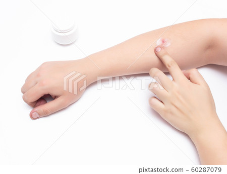 Man smears a medical hormone ointment with a gray red sore pimple on his hand, white background, copy space, dermatology 60287079
